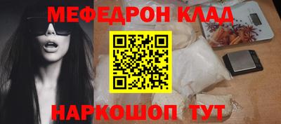 мдпв Обнинск